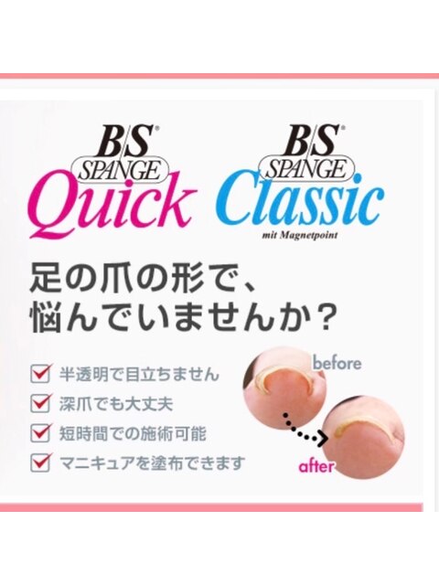 2025年春】【巻き爪矯正】BSブレイス｜BIGLOBE Beauty