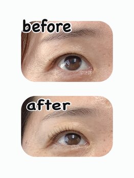 ファーストアイ(First eye)/マイラミネーション