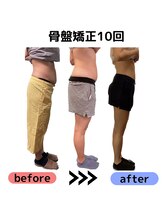 トトノエル/骨盤トトノエル