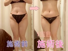 上野エステサロン レア(Lea)の雰囲気（【体験結果の満足度94.3点以上】全国コンテスト入賞◎女性専用）