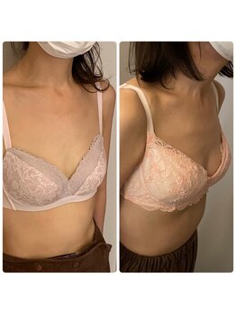 ビジョイ(Bejoy)/エイジングバストのお悩みにも！