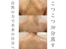 ミミルーチェ(mimiluce)/コツコツ蒸すと綺麗な背中美人に