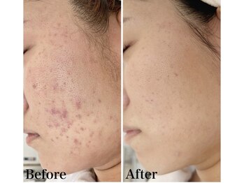 スリリアン 銀座/★お客さまビフォーアフター★