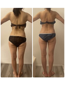 モゼ(moze)/ウルトラ痩身