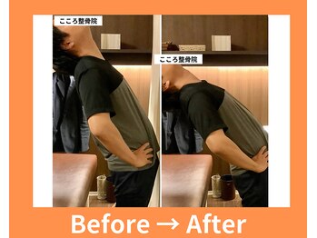 こころ整骨院/30代男性のビフォーアフター