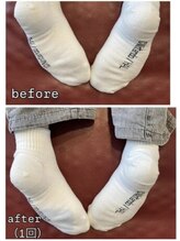 小顔22 ボルティ 本店(Bolty)/【悩み】股関節・骨盤の歪み