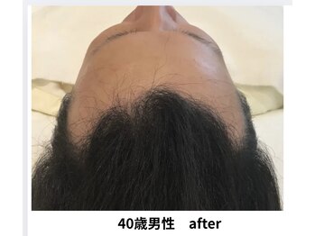 イーズ/リバイタ 梅田本店/【ケース6】