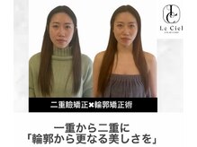 ルシエル/花嫁美容No.1に選ばれる最先端術