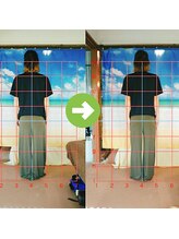 サプライズ整体院/30代ママさんの産後の骨盤初回