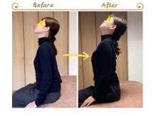 アイノテ メディカルボディケア(Ainote medical body care)/［首・肩こりの施術例紹介］