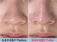 ミスターアンクール 鹿児島(Mr.uncoeur)/おまかせ肌ケア