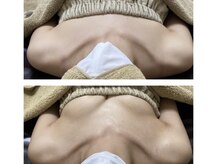 ルアナスタイル(Luana style)/