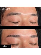 ユー 千葉駅前店(you)/症例写真