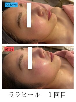 ユフラ(Juhla)/ララピール