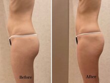 アユーナ(Ayu-Na)/マグブレイク