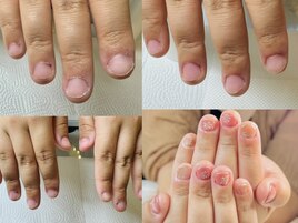 深爪美爪育成ジェル