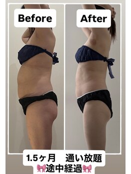 ヴォアール 東静岡店(VOIR)/【new】1.5ヶ月通い放題