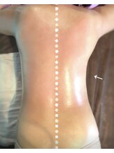 ビューティーツリー(Beauty Tree)/背中・二の腕スッキリ