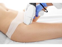 アップパイン(UPPINE)/VIO脱毛¥6,600→¥3,300