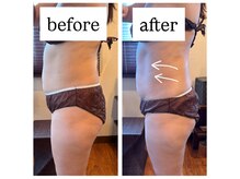 "美容溶解メソッド"気になる腹回り/二の腕/太もも脂肪燃焼