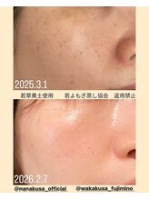 リレフー(Relafy)/★美肌★