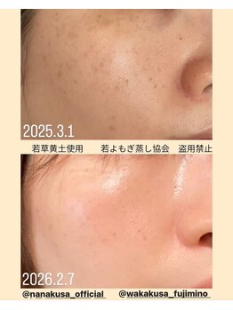 リレフー(Relafy)/★美肌★