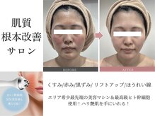 ルヴィアン 柏店(LUVIAN)の雰囲気（完全個室のプライベート空間♪フェイシャル/ボディ/毛穴/美肌）