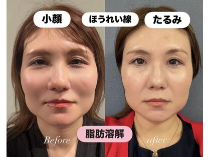ルアナ(Luana)の写真