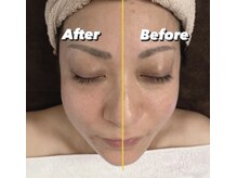 サファイア(sapphire)/小顔になるフェイシャル