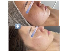 ゆう/ツルスベ肌を手に入れました！