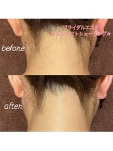 モア ビューティー(MORE beauty)/ブライダルエステ