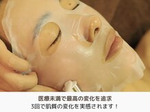 アントルーチェ 代々木上原(Entluce.)/ヒト臍帯幹細胞培養上清液で再生