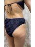 【凸凹のセル脂肪が気になる方へ】　¥8.800（施術箇所はお選びできます）
