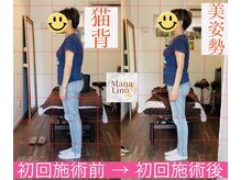 マナリノ(Mana Lino)/1回の施術で驚きの変化が！！