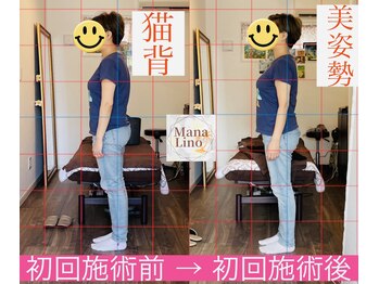 マナリノ(Mana Lino)/1回の施術で驚きの変化が!!