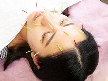 ひびき鍼灸院 整骨院の雰囲気（美容メニューも豊富です！）