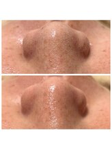 ルシアル(LUCIALL)/