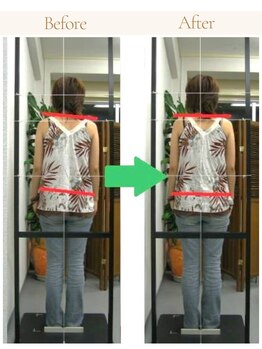 かとう整骨院/ビフォーアフター（全身矯正）