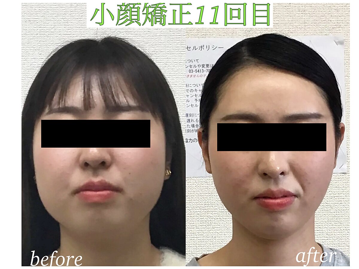 C054029200.jpg?impolicy=