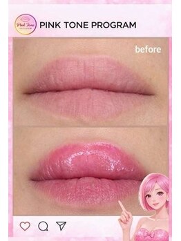 ユヌランコント 岐阜店(Une rencontre)/PinkToneProgram（唇）