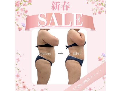 女神デトックスの写真