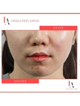 エクラ アン(eclat.un)/ララピール　女性