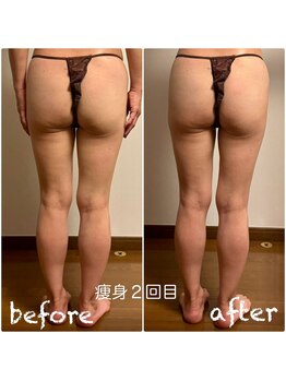 太陽と月/絶対痩せたい!脂肪分解+燃焼!