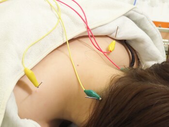 うさぎ鍼灸整骨院/うさぎ式美容鍼