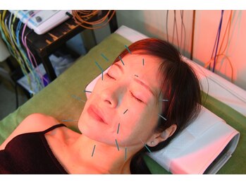 三室中央接骨院の写真/鍼・赤外線・マイクロカレント(微弱電流)の相乗効果で美肌を目指します。ほうれい線・シミ・シワ改善へ。