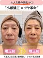 グレースエール トータルビューティーサロン(Grace Aile) 小顔矯正× 美肌革命