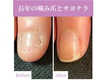 【フォトギャラリー】のビフォーアフター写真をご覧ください♪