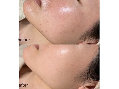 ルアラナ(Lualana)の写真