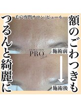 ピュール 鯖江店(PUR)/毛穴/毛穴ケア/毛穴洗浄