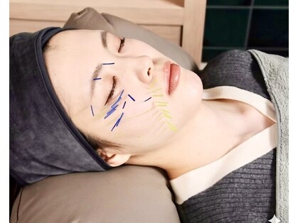 ミエリア美容鍼灸院(mielia美容鍼灸院)の写真